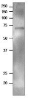 TGG2 | Myrosinase 2 ( BGL37) in the group Antibodies Plant/Algal / Hormones / Brassinosteroids/regulation at Agrisera AB (Antibodies for research) (AS20 4415)